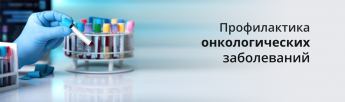 ПРОФИЛАКТИКА ОНКОЛОГИЧЕСКИХ ЗАБОЛЕВАНИЙ.